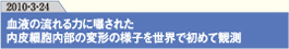 血液の流れる力に曝された内皮細胞内部の変形の様子を世界で初めて観測